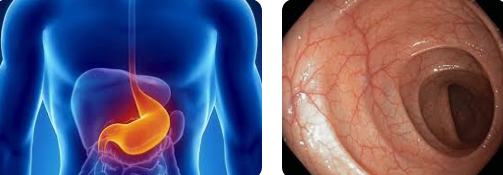 Nuovi endoscopi di ultima generazione all’Ospedale “Madonna del Soccorso”