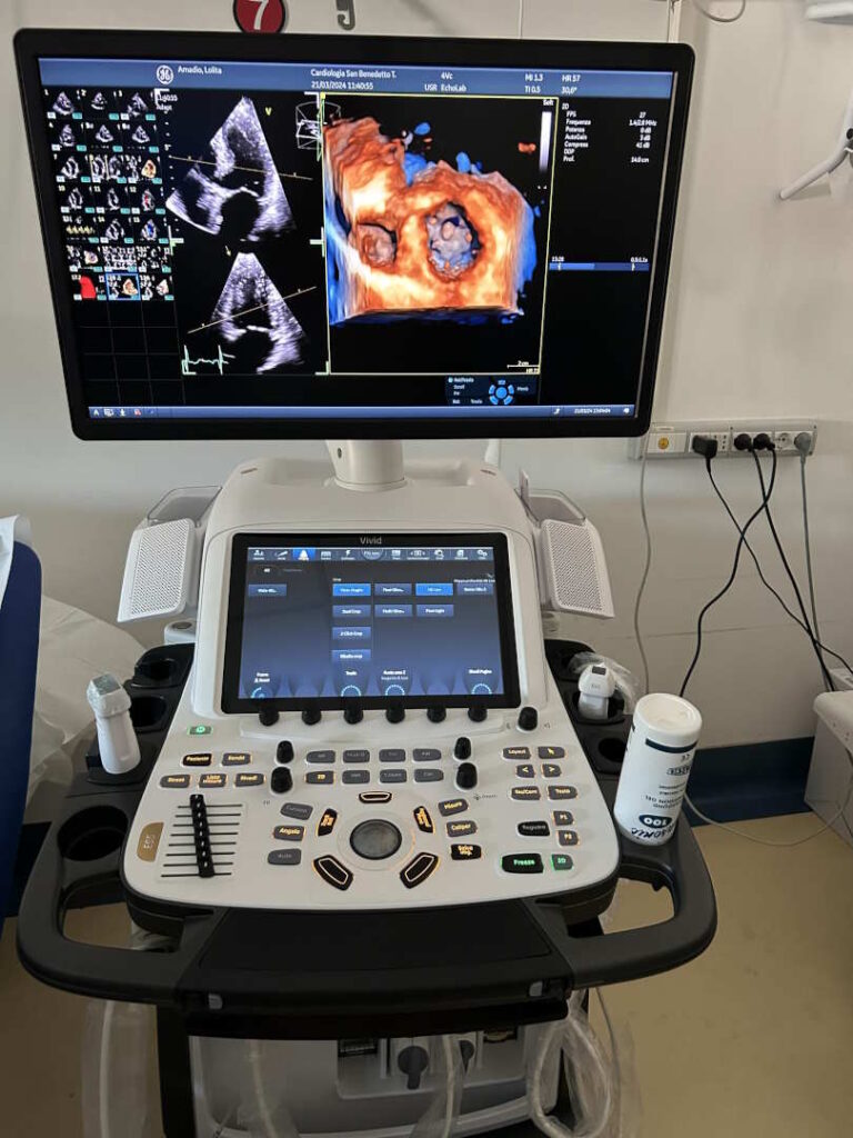 NUOVO ECOGRAFO DI ULTIMA GENERAZIONE ALL’OSPEDALE DI SAN BENEDETTO