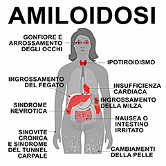 Amiloidosi cardiaca: pazienti, clinici e istituzioni presentano insieme il Position Paper dei bisogni non risposti