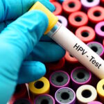 hpv-test