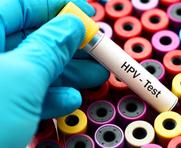 GIORNATA INTERNAZIONALE PER L’ELIMINAZIONE DEL TUMORE ALLA CERVICE UTERINA