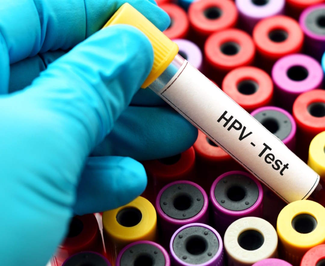 hpv-test
